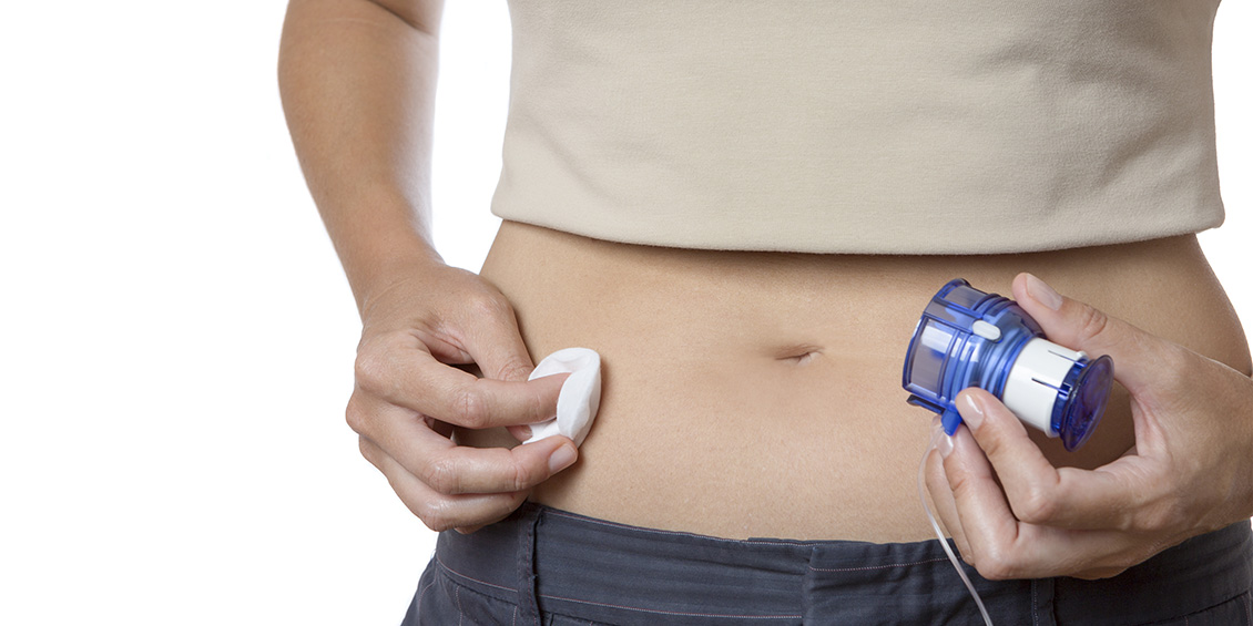 photo of insulin pump